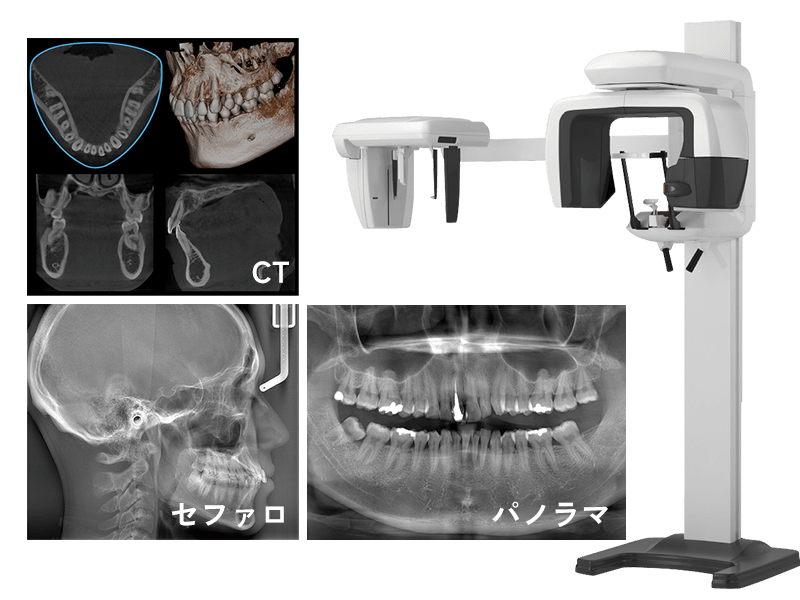歯科用CT・レントゲン